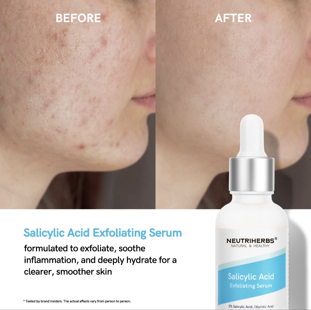 2% Salicylic Acid Exfoliating Serum thumbnail 4